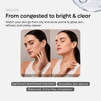 2% Salicylic acid serum