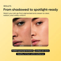 Kojic Acid Turmeric Niacinamide Serum