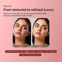 SCARDI Dragon's Blood Microneedling Serum