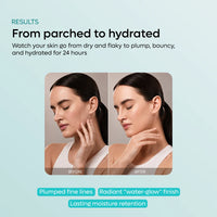 SCARDI PDRN Centella Microneedling Serum (Collagen)