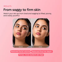 Cica Collagen Microneedling Serum