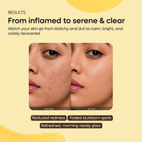 Turmeric Night Wrapping Mask